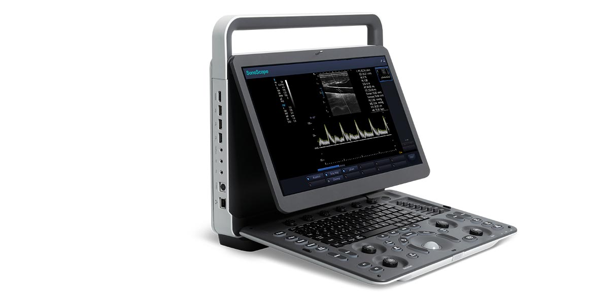 E1 Sonoscae Ultrasound